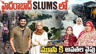 A day in the Hyderabad Slum | 1402 slums in Hyderabad | Ravi Telugu Traveller