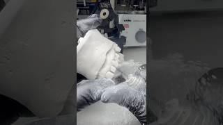 Prepping for a Cosmetic Restoration #lsk121shorts #dentist #teeth
