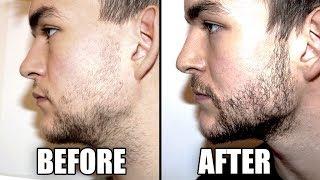 Trying a Beard Growth Kit for 2 Months - My RESULTS | CPH Grooming Review