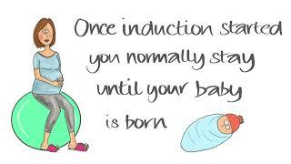 How long will induction of labour take?