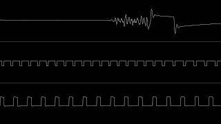 Stinsen & Mr.Death - Arpalooza {C64, oscilloscope view}