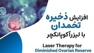 Laser Acupuncture for Diminished Ovarian Reserve --- افزایش ذخیره تخمدان با لیزر آکوپانکچر