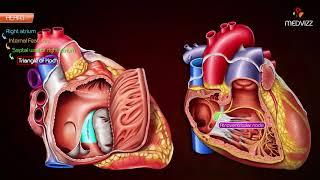 Gross anatomy of Right atrium (RA) Animation | Usmle step 1 , National exit test