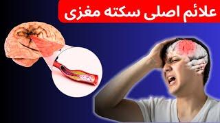 علائم اصلی سکته مغزی