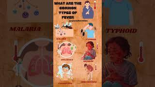 What are the common types of fever.