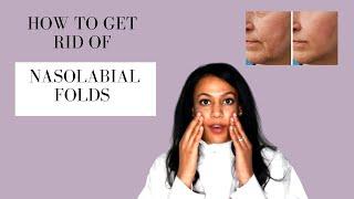 How To Get Rid of Mouth Lines - Best Nasolabial Folds Treatments