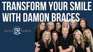 Damon Braces