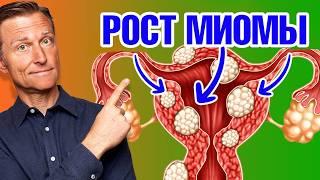 Как уменьшить миому матки? Самый эффективный способ!