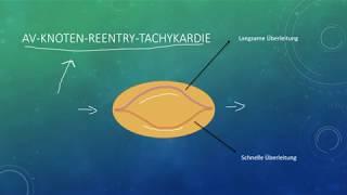 EKG befunden leicht gemacht, Teil 6