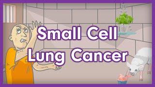 Small Cell Lung Cancer (Small Cell Carcinoma) | USMLE Step 1 Mnemonic