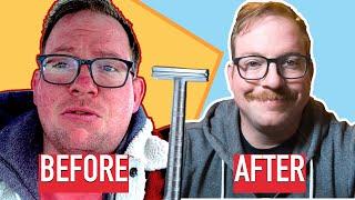 Did a Henson Safety Razor Cure my Acne in 30 Days?