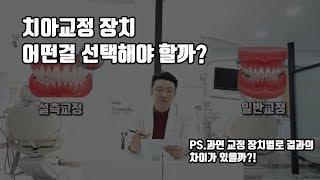 치아교정종류 치료 결과에 많은 영향을 미칠까?