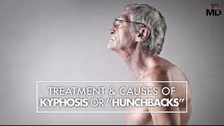 Treatment and Causes of Kyphosis or "Hunchback" | Dr. Mark Valente | Top10MD