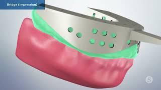 DENTAL CROWNS & BRIDGES 2