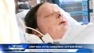 Chimp maul victim, Charla Nash, gets $4m payout