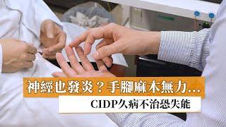 【黃柏豪醫師】神經也發炎？手腳麻木無力…　CIDP久病不治恐失能｜健康醫療網