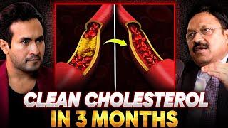 Clean Cholestrol in 3 Months Naturally (Doctors DON'T Want You to KNOW THIS!)