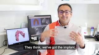 Tips to Take Care of Dental Implants By Dr. Vikash Makan (Dentist@330)