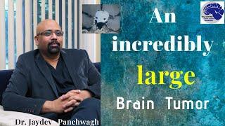 #6.Brain Tumors-Incredibly large and in critical locations. Dr Jayadev Panchwagh