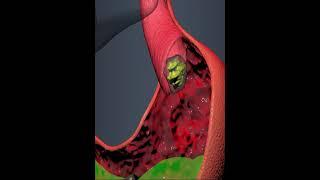 Digestive system- Food enters in to the stomach sphincters muscles (3D Animation)