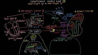 Insuffisance rénale aiguë - Docteur Synapse