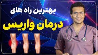 رگ های واریسی تو خیلی راحت توی خونه درمان کن | Micro sclerotherapy and exercise for spider veins