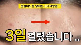 광고 only 홈 케어, 지긋지긋한 좁쌀여드름 없애는 방법 | 여드름, 속건조, 유수분밸런스 다 잡는 방법