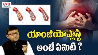 యాంజియోప్లాస్టి అంటే ఏమిటి ? | What is angioplasty? | CVR Health