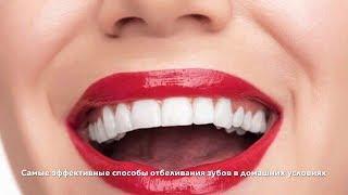 perfect smile veneers спб