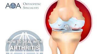 AOA Orthopedic Specialists - Dr. Don Stewart - How to Deal with Arthritis