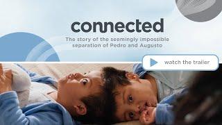 connected documentary trailer || conjoined twins separation || Dayton Children's Hospital