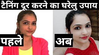 सन टैनिंग हटाने के घरेलू आसान उपाय | Sun Tan Removal Home Remedy | Remove tan | skin detan|detanned