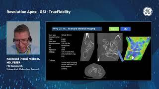 Deep Learning Reconstruction in CT and MR: a game changer?