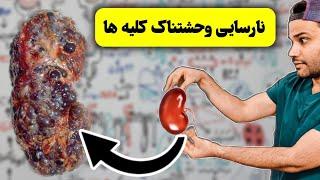 نارسایی مزمن کلیوی | علایم | علت | مکانیسم | CKD