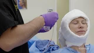 Pre Operative Video: Deep Plane Facelift & Necklift | Stanislaw Facial Plastic Surgery Center