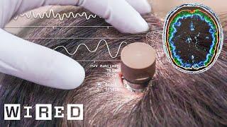 The Science Behind Elon Musk’s Neuralink Brain Chip | WIRED