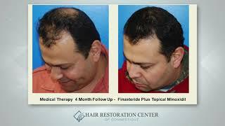 Medical Therapy Solutions For Hair Loss - Scott Boden, MD