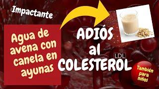 EL COLESTEROL ALTO ESTÁ AFECTANDO A NIÑOS Y ADULTOS ¡CUIDADO!