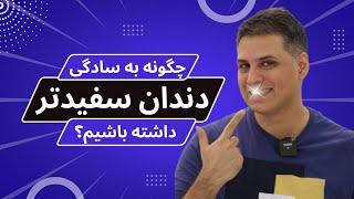 نکاتی مهم درباره انجام بلیچینگ یا سفید کردن دندانها | بلیچینگ دندان چطوری انجام میشه؟