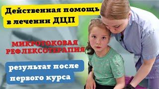 Микротоковая рефлексотерапия. Эффективное лечение ДЦП. Результат после первого курса.