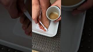 Самый быстрый способ избавиться от грибка ногтей #советы #лайфхак #грибокногтей #tips #lifehacks