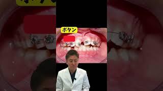 様々な器具を使います！ #歯医者 #歯列矯正  #矯正 #美容 #ワイヤー矯正