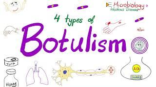 Four Types of Botulism | Food-borne botulism, Infant botulism, Wound botulism & Inhalation botulism