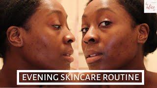 SUNDAY RILEY U.F.O. OIL UPDATED EVENING SKINCARE ROUTINE | BLACK GIRL SKINCARE | byalicexo