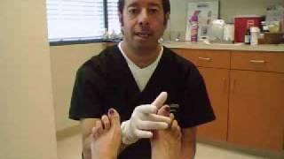 Corns and Calluses