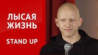 СТЕНДАП  Алексей Белобородов | Жизнь без волос