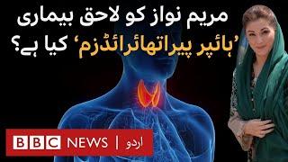 Maryam Nawaz: Can  Hyperparathyroidism Be Treated Only in US and Switzerland? - BBC URDU