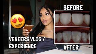 WENT TO COLOMBIA TO FIX MY TEETH | REMOVAL OF COMPOSITE VENEERS TO 100% PORCELAIN W/. DR D