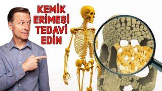 Kemik Erimesi (Osteoporoz) Kalsiyum Eksikliği Değildir – Osteoporoz Tedavileri | Dr.Berg Türkçe