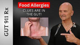 SOLVING FOOD ALLERGIES: CLUES ARE IN THE GUT! Dr. Krystosik